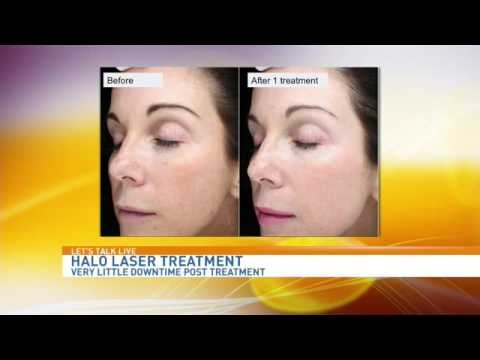 Let's Talk Live: Sciton Halo Laser Treatment - Dr. Elizabeth Tanzi, Capital Laser & Skin Care